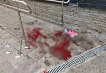 Через російські обстріли на Херсонщині є загиблий і поранені